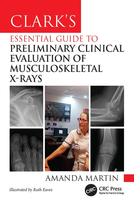 Clark’s Essential Guide to Preliminary Clinical Evaluation of Musculoskeletal X-rays: Evaluating and Commenting on Images