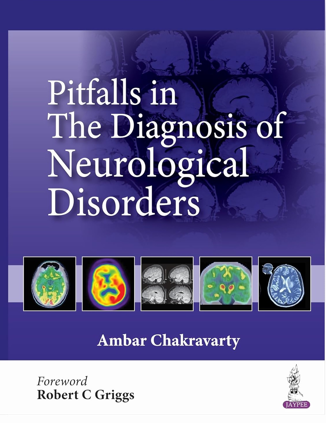 Pitfalls in the Diagnosis of Neurological Disorders